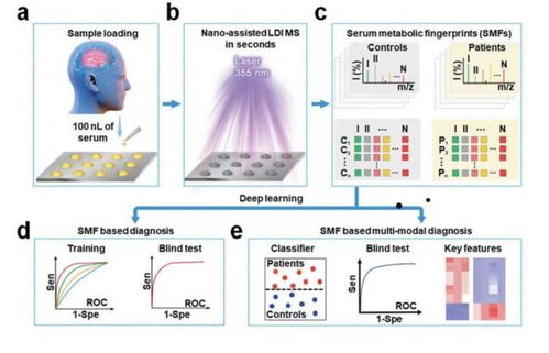 腦卒中快速診斷的革命性突破 中國學者引領的計算機輔助軟硬件研發新紀元